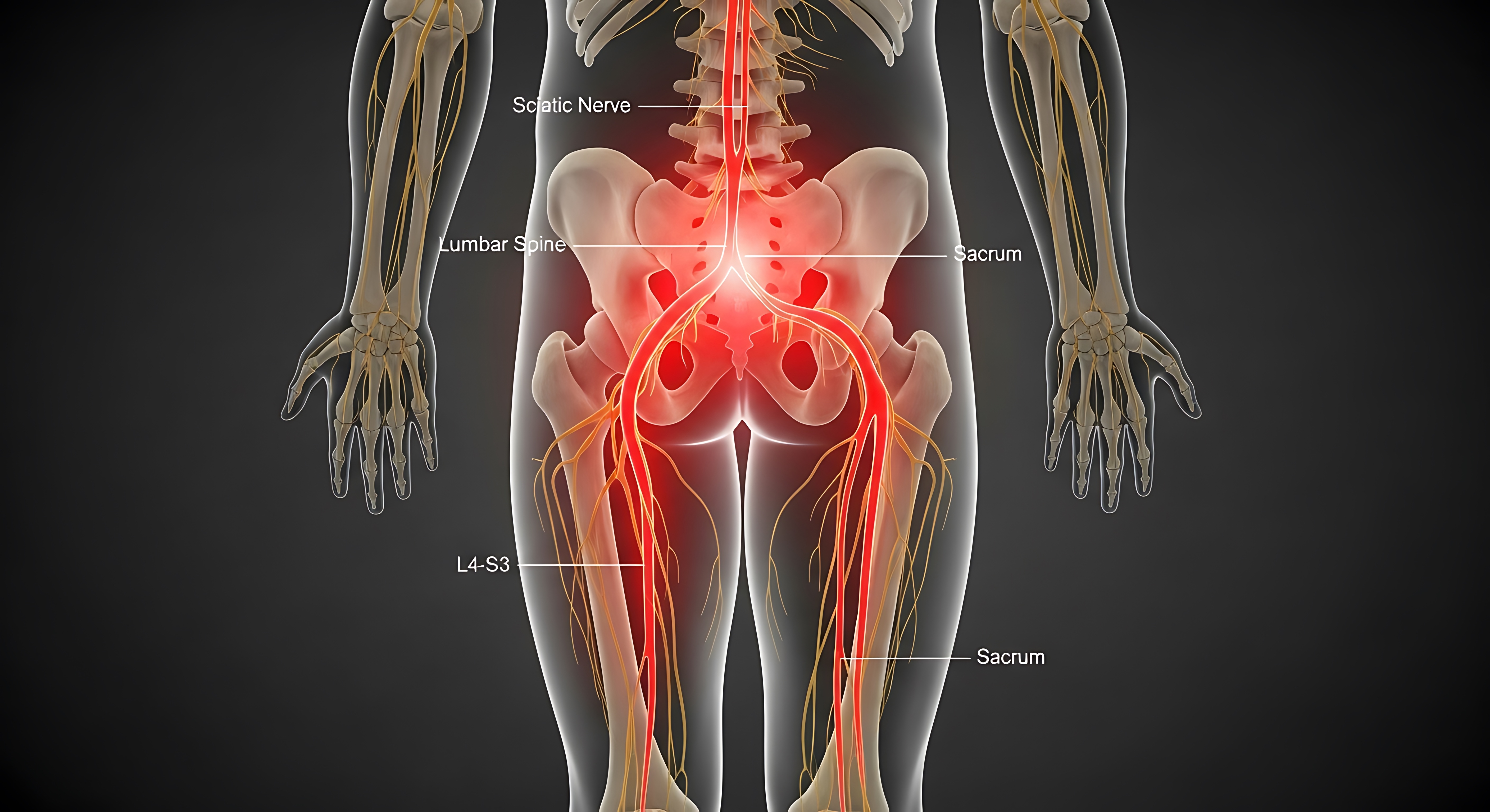 Diagram showing sciatic nerve path from spine through buttock and leg